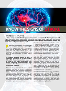 Signs of a possible stroke